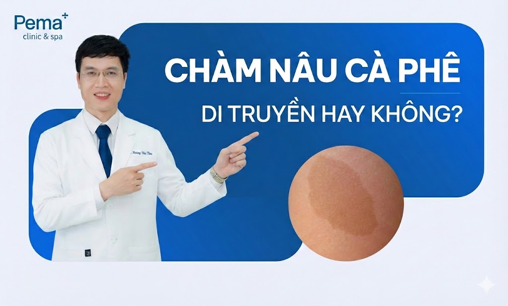 Chàm nâu cà phê có di truyền hay không ?