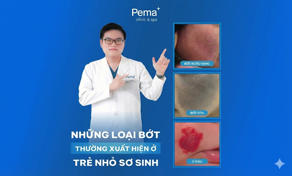 Những loại bớt thường xuất hiện ở trẻ nhỏ sơ