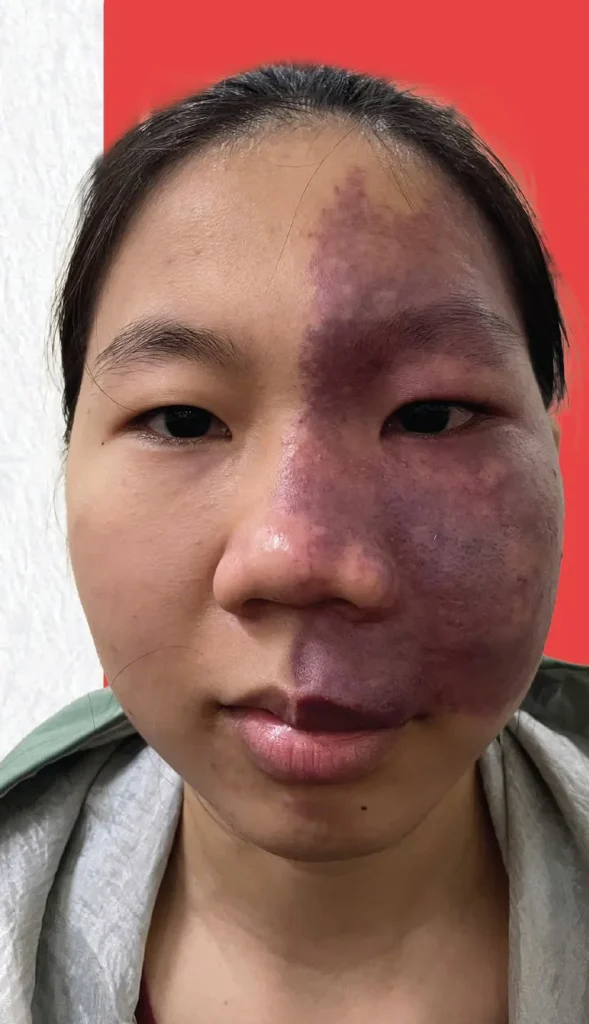Nguyễn Thị Hiếu Ngân